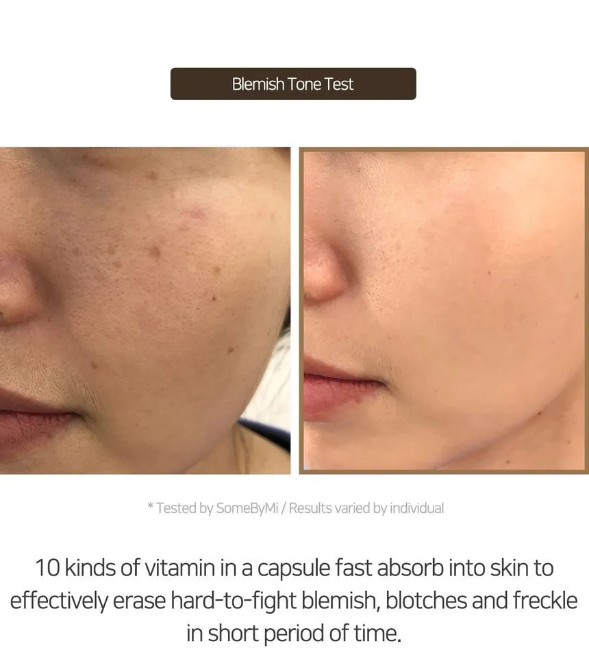 SOME BY MI Galactomyces Pure Vitamin C Glow Serum