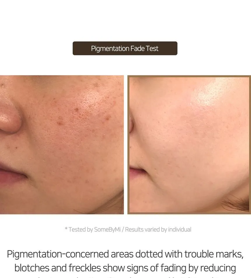 SOME BY MI Galactomyces Pure Vitamin C Glow Serum