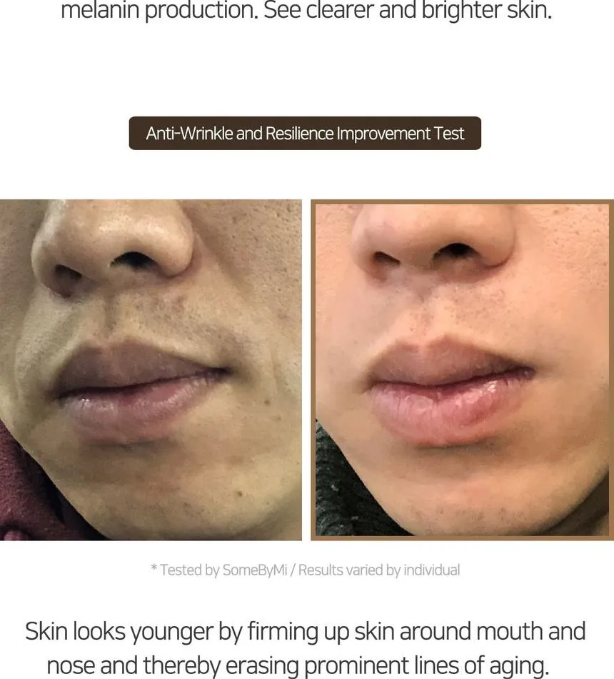 SOME BY MI Galactomyces Pure Vitamin C Glow Serum
