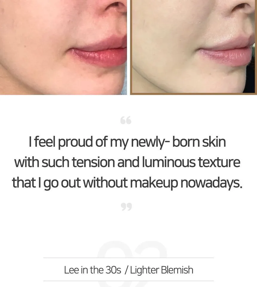SOME BY MI Galactomyces Pure Vitamin C Glow Serum