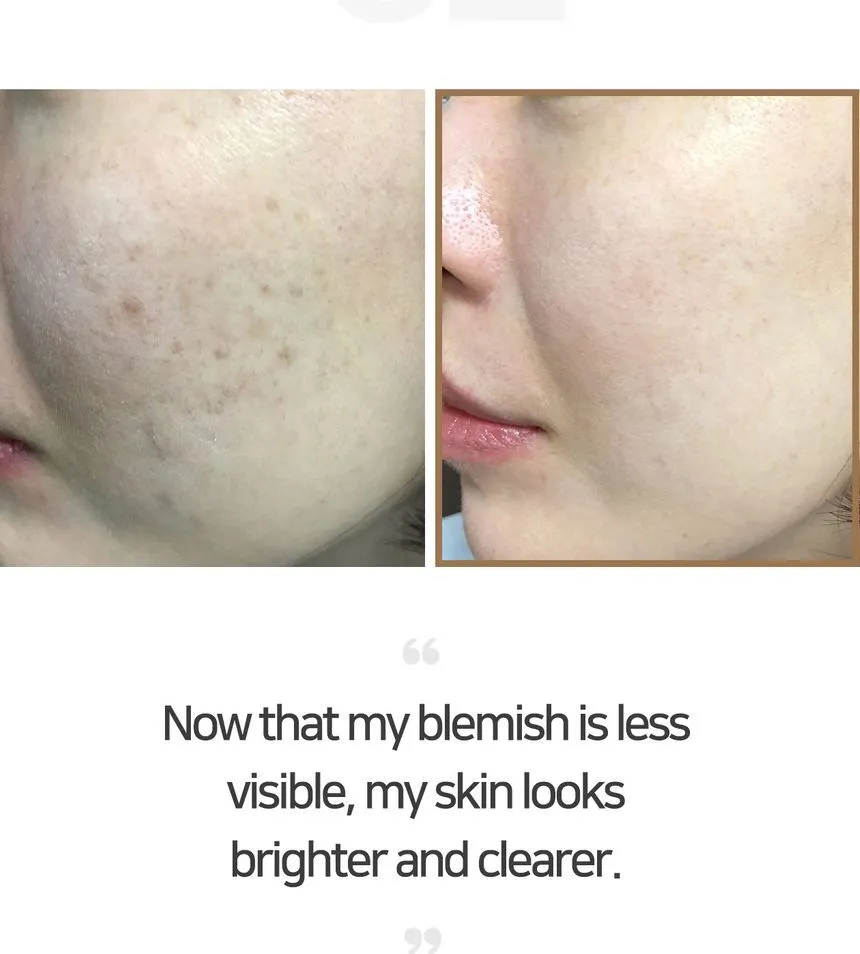 SOME BY MI Galactomyces Pure Vitamin C Glow Serum
