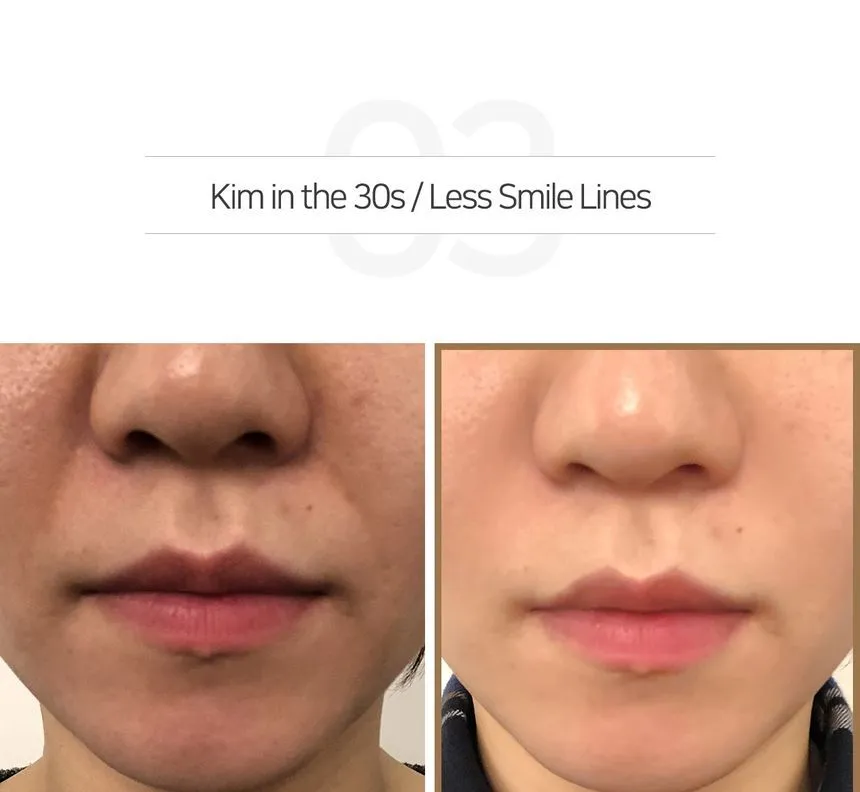 SOME BY MI Galactomyces Pure Vitamin C Glow Serum